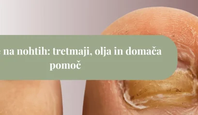 Prizadet noht na palcu na nogi z izrazito rumenkasto, zadebeljeno in spremenjeno nohtno ploščo, čez katero poteka zelen pas z napisom “Glivice na nohtih: tretmaji, olja in domača pomoč”.