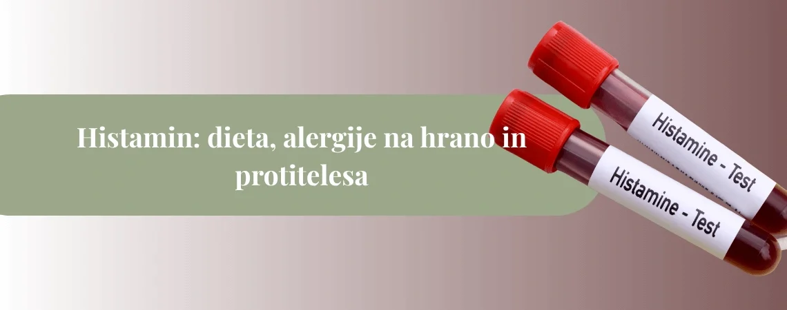 Epruveti z oznako “Histamine – Test” na svetlem ozadju kot naslovna slika članka o histaminu, dieti in alergijah.