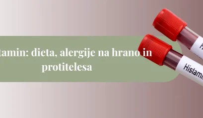 Epruveti z oznako “Histamine – Test” na svetlem ozadju kot naslovna slika članka o histaminu, dieti in alergijah.